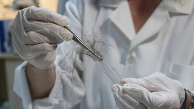 Doç. Dr. Dağlıoğlu, “Birçok kanser türüne neden oluyor” diyerek uyardı! Bilimsel araştırmada kanıtlandı