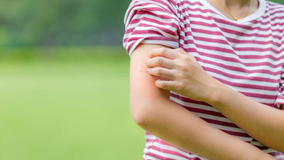 Türk profesör artış büyük olacak diyerek uyardı. Türkiye bu yaz kabusu yaşayacak