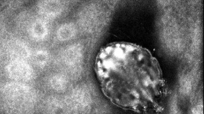 Vücutta yaralar açıyor uykusuz geceler yaşatıyor. İstanbul bu hastalığın pençesinde