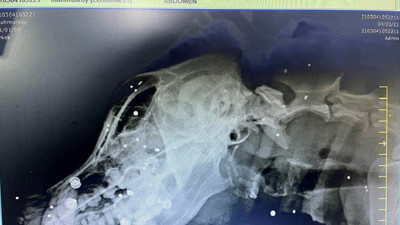 Vicdansızlık röntgen çekilince ortaya çıktı. Vücudunun her yerinde vardı