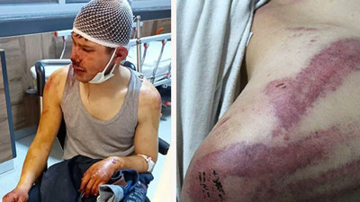 Yıkılsın bu dünya. 16 yaşındaki çocuğu bu hale getirdiler. Yok mu bu şehrin bir yetkilisi