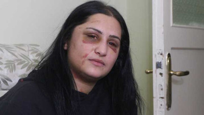 Bu görüntüler Türkiye'yi ayağa kaldırmıştı. Samsun'da eski eşi tarafından dövülen Emrihe Metegül yaşadığı dehşet anlarını anlattı