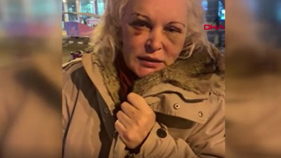 Otel odasında öldüresiye dövülen Rus Otteva Elvira gönderdiği videoyla her şeyi anlattı