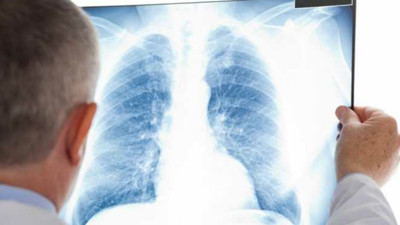 Gizemli hastalıktan kız öğrenciler hastaneye kaldırıldı