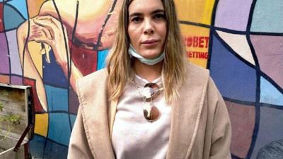 Güzellik merkezinde skandal. Lazer epilasyonuna gitti bacakları yandı