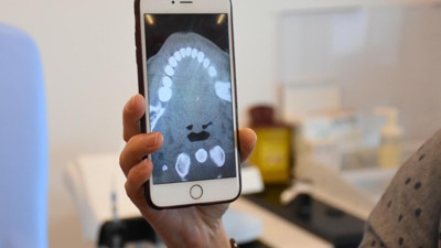 İzmir'de kokoreç yerken diline takıldı. Doktorlar bile şaşırtıcı buldu