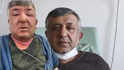 Kullandığı dezenfektan hastanelik etti. Tedavisi 14 gün sürdü