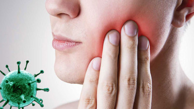 Diş eti iltihabı koronadan ölme riskini 9 kat artırıyor. Kanadalı bilim insanları ortaya çıkardı