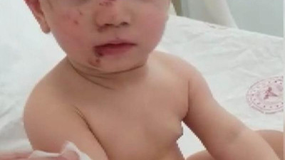 6.kattan düşen 2 yaşındaki çocuk kurtuldu