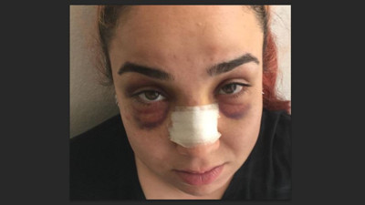 Pastacı kadına süpürgeli dayak