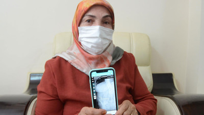 Çekilen röntgen şaşkına çevirdi