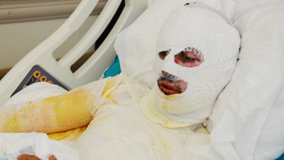 Talihsiz çoban hastanelik oldu