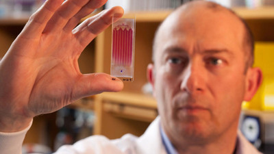 Türk profesör kanser hastalarına umut oldu