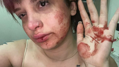 Ünlü oyuncudan fenomen Başak Ermiş'e bayıltan dayak