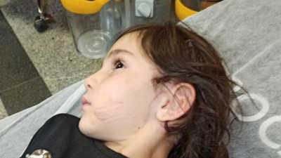 Dinar'da sevdiği köpek 6 yaşındaki kıza dehşeti yaşattı