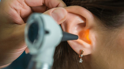 Kadının kulağından çıkan doktorları şaşkına çevirdi