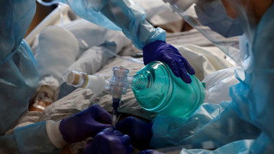 ‘Maymun Çiçeği Virüsü’ şimdi de ABD’de ortaya çıktı