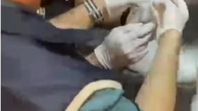 Halüsinasyon gördürüyor derilerini parçalatıyor