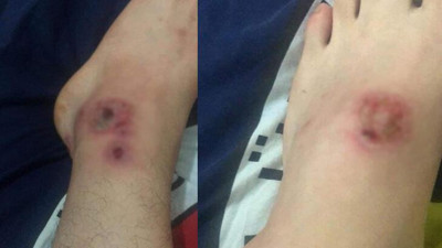 Ölümcül tehlike İstanbul geneline yayıldı