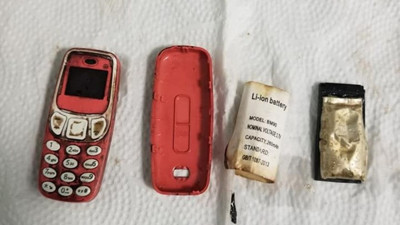 Doktorları bile şaşkına çevirdi. Midesinden Nokia 3310 çıktı