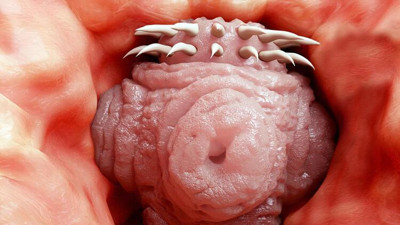 Hayvandan insana geçiyor beyni tamamen istila ediyor