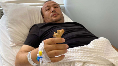 Böbreğinden geyik boynuzu çıktı