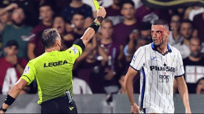 Merih Demiral kanlar içinde kaldı