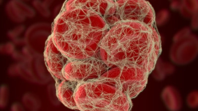 Bu belirtilere dikkat. Ölümcül olabilir