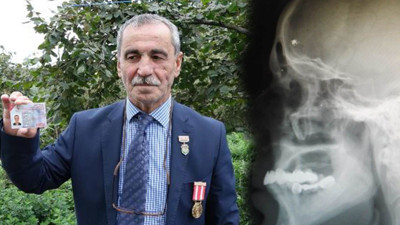 Büyük çatışmadan 43 yıl sonra ortaya çıktı