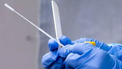 Diş fırçalar gibi korona virüs testi. İmzalar atıldı