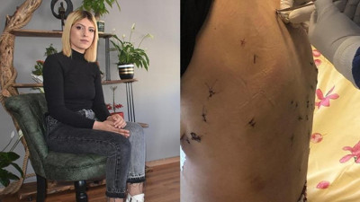 Çocukluk aşkını bu hale getirdi