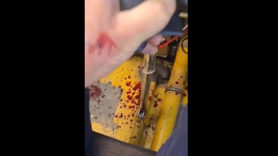 Pilotun ayaklarının altı kan içinde kaldı