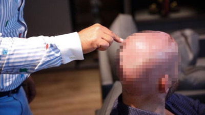 Saç ekimi sırasında yaşamını yitirdi