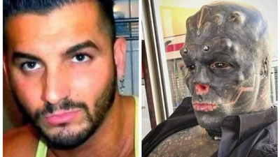 Cerrahlar bile emin misin diye defalarca sordu