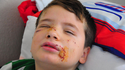 Sokak köpeği dehşeti. 8 yaşındaki çocuğa sokak köpekleri saldırdı