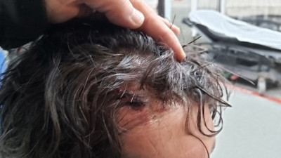 Hürriyetçi Eğitim Sen Genel Sekreteri saldırıya uğradı