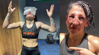 Miriam Gutierrez Amanda Serrano'dan 237 yumruktan sonra bu hale geldi