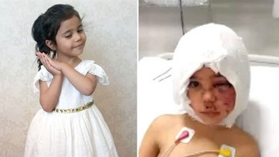 Pitbull saldırısına uğrayan Asiye'den yürek burkan soru: Yüzüm iyileşecek mi