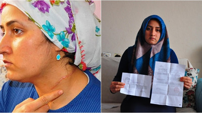 Eşi tarafından boğazı falçatayla kesilerek yaralanan Esra'ya haciz şoku