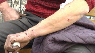 Gaziantep'te yine pitbull dehşeti