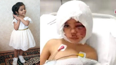 Pitbullar saldırdığı 4 yaşındaki Asiye’nin sağlık durumu hakkında yeni gelişme