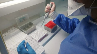 Araştırma: Fransa’da 46 mutasyona sahip Covid-19 varyantı tespit edildi