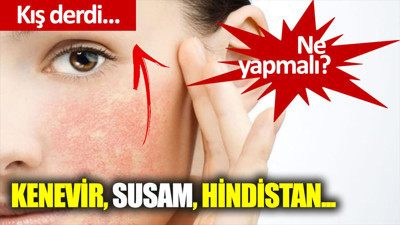 Kışın cilt kuruluğu nasıl canlandırılır ?