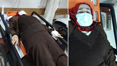 Aydın'da sokak köpekleri yaşlı kadını hastanelik etti (16 Ocak 2022)