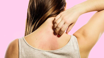 Kaşınmanın sebebini uzman isim açıkladı