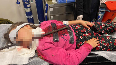 Küçük Seçil yaşam mücadelesini kazandı