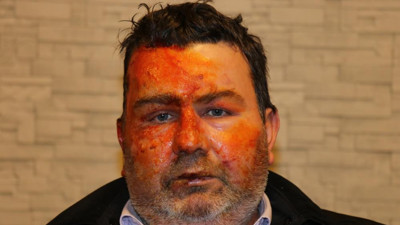 Derin uykuda dehşeti yaşadı diri diri yanarken uyandı