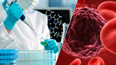 Bıçak değince kanser yayılır söylentisi tedaviyi geciktiriyor