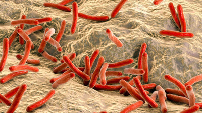 Erken tedavi edilmediğinde öldürücü olabiliyor