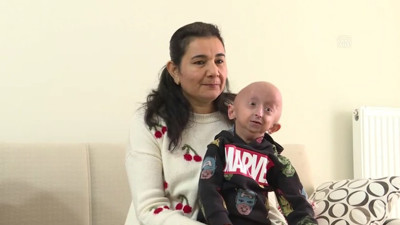 8 milyonda 1 görülüyor | 9 yaşındaki Veysel’in “Benjamin Button” hastalığıyla mücadelesi!